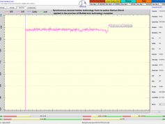 dxsatcs-eutelsat-21b-western-multistream-reception-snrt-morocco-11618-v-signal-monitoring-A03