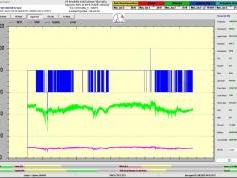 dxsatcs-express-am7-40e-sat-reception-prodelin-450cm-KU-Fixed-beam-Russia-11070-V-NNTV-77h-signal-monitoring-A01