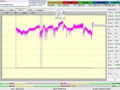 dxsatcs-rascom-qaf-1r-south-north-africa-79h-monitoring-TBS-monitoring-A02
